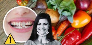 Alimenti macchiano denti