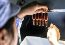 Con questa infiammazione rischi il tumore