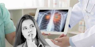 Novità sulla recidiva del tumore al polmone