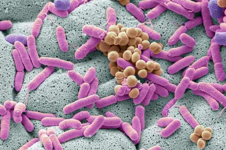 Listeria, cosa c'è da sapere