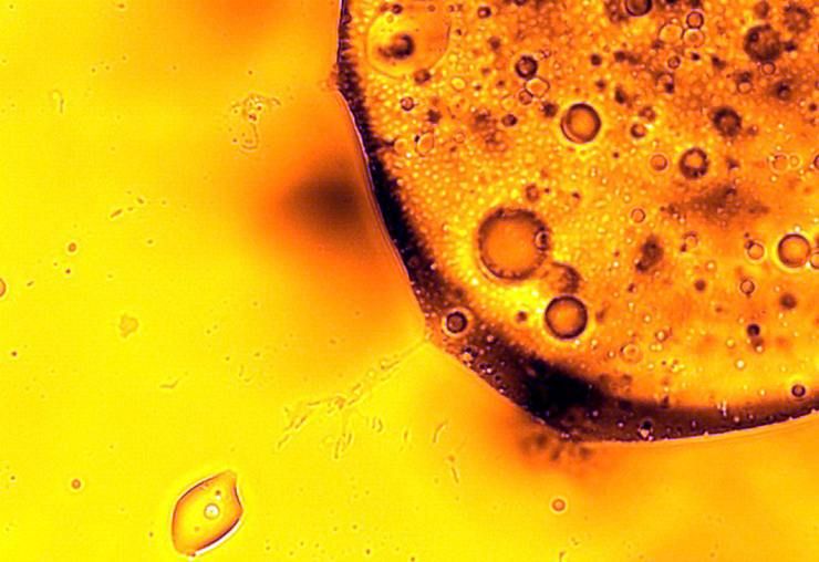 sudore ascelle causato da microrganismi: rebus deodorante 