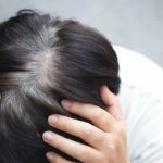 testa con capelli neri e grigi